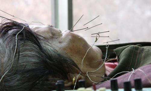 警惕!气温骤变,多人中招口眼歪斜、面部麻木……此季高