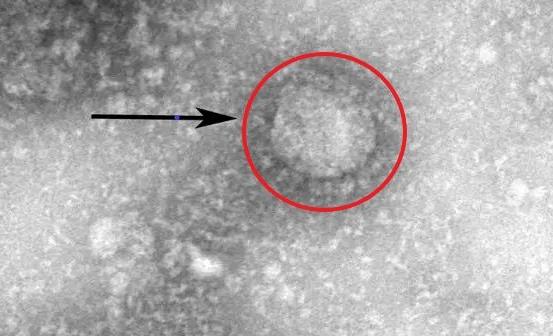 预防新冠病毒忌口有四 家里勤消毒助力抗疫早日成功